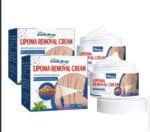 Herbal Lipoma Removal Cream | Targeted Fatty Nodule Care