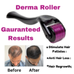 Derma Roller 540 Needles for Skin & Hair Therapy - Image 2